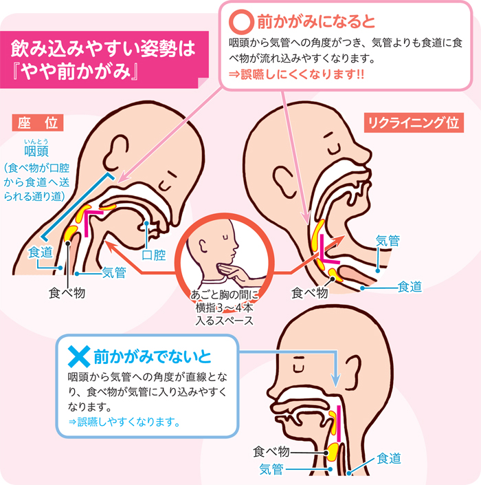 摂食嚥下障害について 病気について知る 日々の食事選びのサポートサイト ヘルシーネットワークナビ