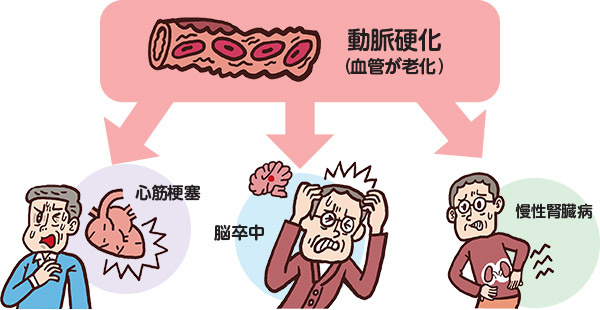 心筋梗塞・脳卒中・慢性腎臓病