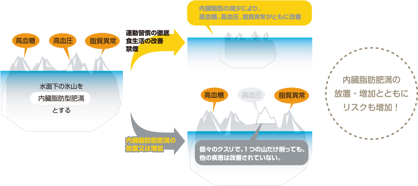 メタボリックシンドロームとは | 日々の食事選びのサポートサイト ヘルシーネットワークナビ